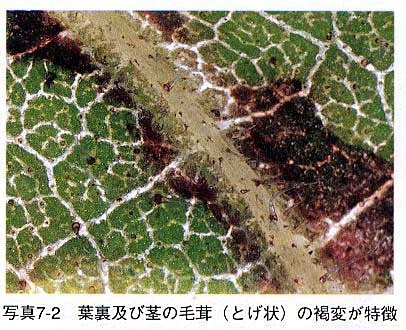 症状2 症状2